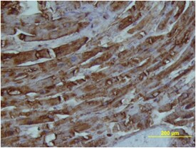 FABP3/H-FABP antibody in Human Heart by Immunohistochemistry (IHC-P).