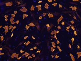 FABP4 antibody in Rat Mesenchymal Stem Cells by Immunocytochemistry (ICC).