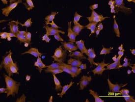 FABP5 antibody in HUVEC Human Cells by Immunocytochemistry (ICC).