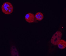 Phospho-FADD (S194) antibody in HeLa Human Cell Line by Immunocytochemistry (ICC).