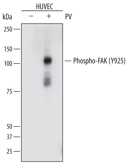 Detection of Human Phospho-FAK (Y925) antibody by Western Blot.