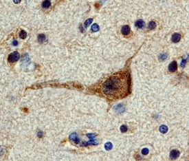 FAK antibody in Human Brain by Immunohistochemistry (IHC-P).