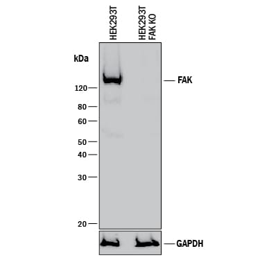 Western Blot Shows Human FAK Antibody Specificity by Using Knockout Cell Line.