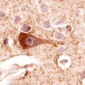 FAK antibody in Human Brain by Immunohistochemistry (IHC-P).