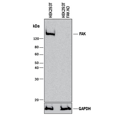 Western Blot Shows Human FAK Antibody Specificity by Using Knockout Cell Line.