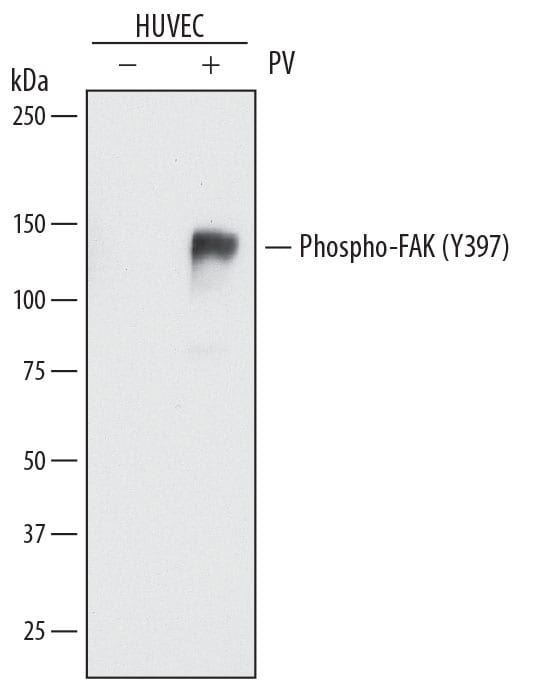 Detection of Human Phospho-FAK (Y397) antibody by Western Blot.