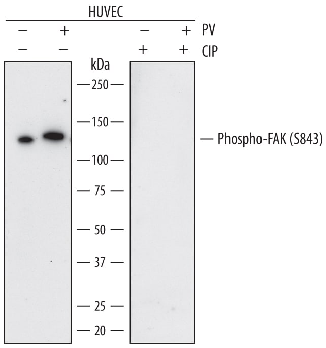 Detection of Human Phospho-FAK (S843) antibody by Western Blot.