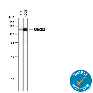 Detection of Human FANCD2 antibody by Simple WesternTM.