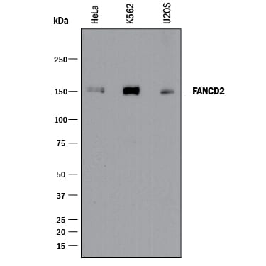 Detection of Human FANCD2 antibody by Western Blot.
