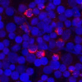FGFBP2 antibody in Human PBMCs by Immunocytochemistry (ICC).