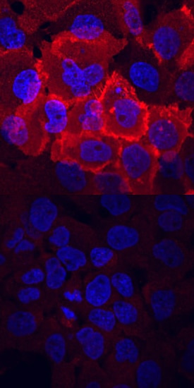 Phospho-FGF R1-4 (Y653/Y654) antibody in A431 Human Cell Line by Immunocytochemistry (ICC).