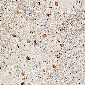 FGF acidic/FGF1 antibody in Human Brain by Immunohistochemistry (IHC-P).