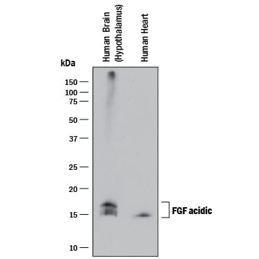 Detection of Human FGF acidic/FGF1 antibody by Western Blot.