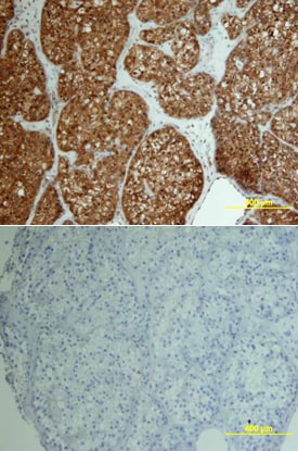 FGF basic/FGF2/bFGF antibody in Human Ovary by Immunohistochemistry (IHC-P).