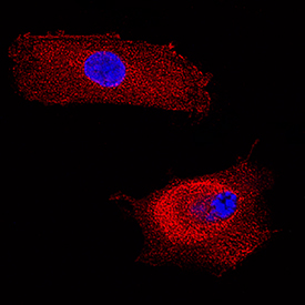 FGL2 antibody in WI-38 Human Cell Line by Immunocytochemistry (ICC).