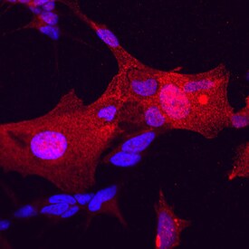 FHL1 antibody in SH-SY5Y Human Cell Line by Immunocytochemistry (ICC).