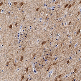 FKBP12 and FKBP12 by Immunohistochemistry (IHC-P).6 antibody in Human Brain by Immunohistochemistry (IHC-P).