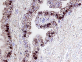 FKBP51 antibody in Human Prostate by Immunohistochemistry (IHC-P).