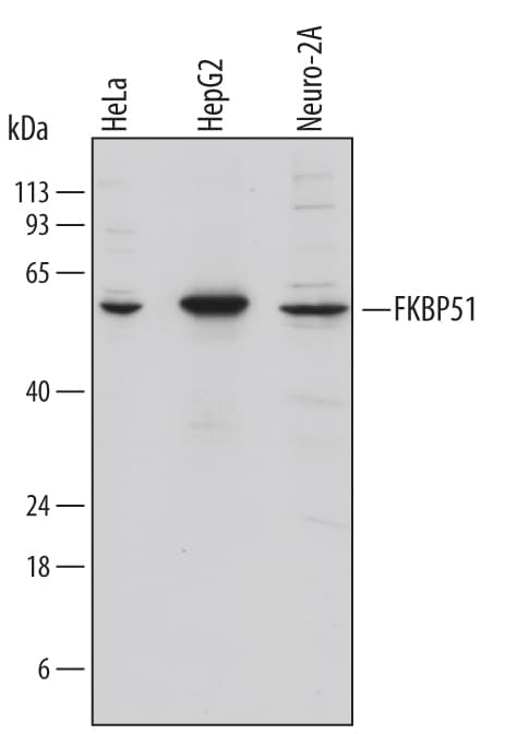 Detection of Human and Mouse FKBP51 antibody by Western Blot.