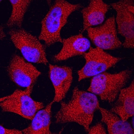 FOLR1 antibody in HeLa Human Cell Line by Immunocytochemistry (ICC).