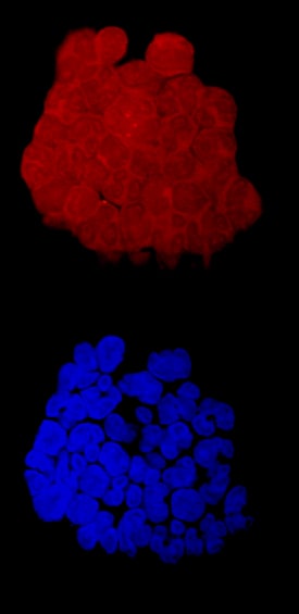 FOLR2 antibody in Human Neutrophils by Immunocytochemistry (ICC).
