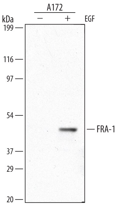 Detection of Human FRA-1 antibody by Western Blot.