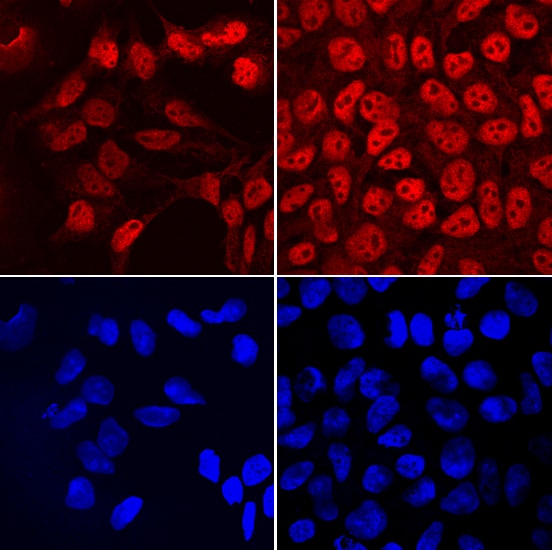 FRAT2 antibody in NTera-2 Human Cell Line by Immunocytochemistry (ICC).