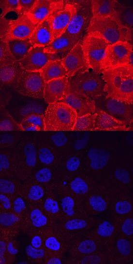 Phospho-FRS2 (Y436) antibody in A431 Human Cell Line by Immunocytochemistry (ICC).