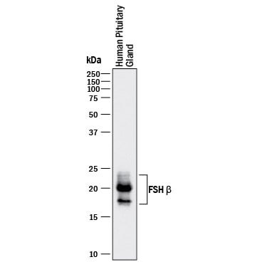Detection of Human FSH  beta  antibody by Western Blot.