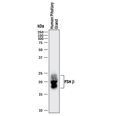Detection of Human FSH  beta  antibody by Western Blot.