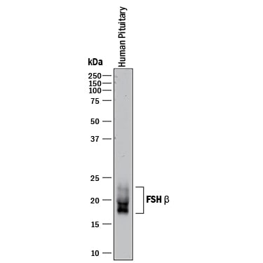 Detection of Human FSH  beta  antibody by Western Blot.