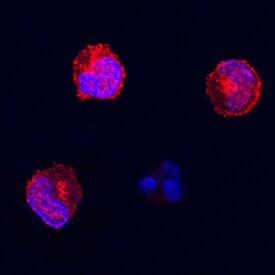Fas/TNFRSF6/CD95 antibody in Feline PBMCs by Immunocytochemistry (ICC).