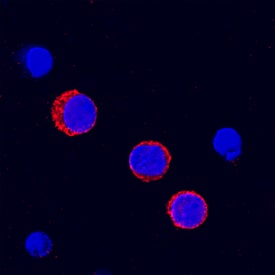 Fc? RII/CD32 antibody in Human PBMCs by Immunocytochemistry (ICC).