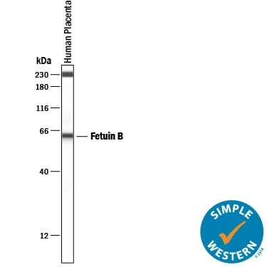 Detection of Human Fetuin B antibody by Simple WesternTM.