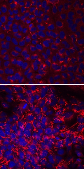 Fibronectin antibody in A549 Human Cell Line by Immunocytochemistry (ICC).