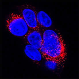 Fibronectin antibody in HepG2 Human Cell Line by Immunocytochemistry (ICC).