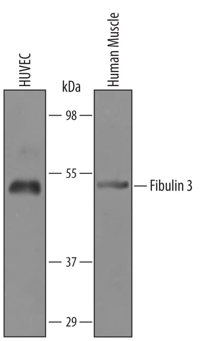Detection of Human Fibulin 3 antibody by Western Blot.