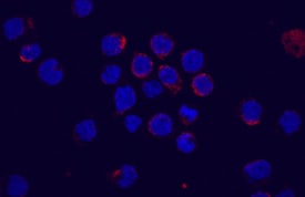 Flt‑3/Flk‑2 antibody in M1 Mouse Cell Line by Immunocytochemistry (ICC).