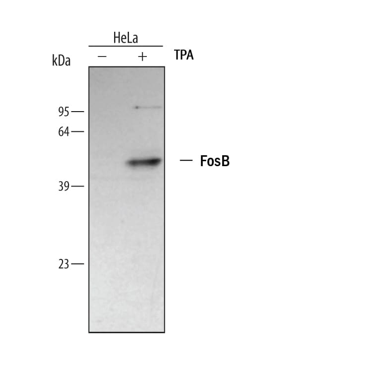 Detection of Human FosB/G0S3 antibody by Western Blot.