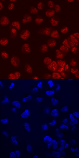 FoxC2 antibody in MDA-MB-453 Human Cell Line by Immunocytochemistry (ICC).