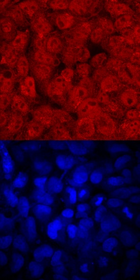 FoxD3 antibody in BG01V Human Stem Cells by Immunocytochemistry (ICC).