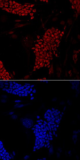 FoxD3 antibody in D3 Mouse Stem Cells by Immunocytochemistry (ICC).