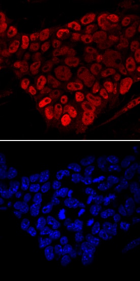 FoxD3 antibody in D3 Mouse Stem Cell Line by Immunocytochemistry (ICC).