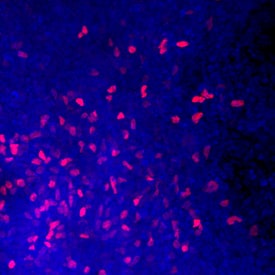 FoxJ1 antibody in Early Proximal Lung Progenitors by Immunocytochemistry (ICC).