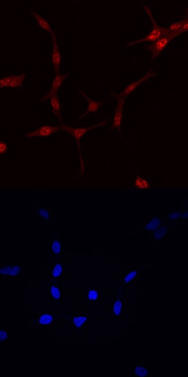 FoxO1/FKHR antibody in LNCaP Human Cell Line by Immunocytochemistry (ICC).
