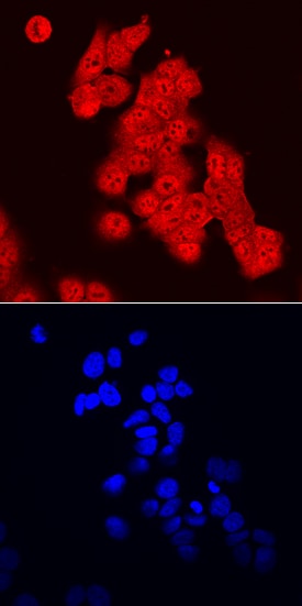 FoxO3 antibody in MCF-7 Human Cell Line by Immunocytochemistry (ICC).
