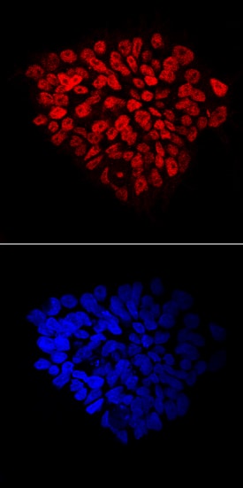 FoxP1 antibody in BG01V Human Embryonic Stem Cells by Immunocytochemistry (ICC).
