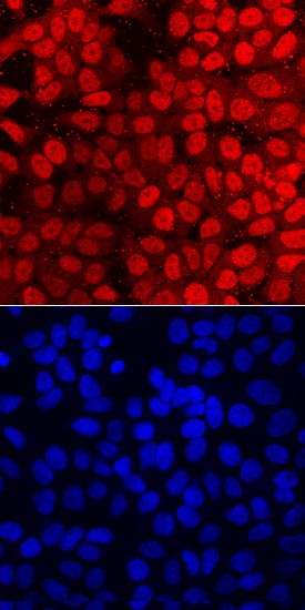FoxP1 antibody in MCF-7 Human Cell Line by Immunocytochemistry (ICC).