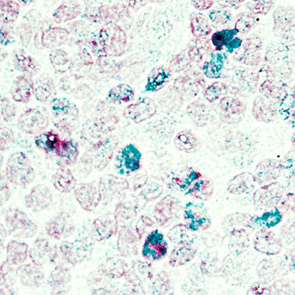 FoxP3 antibody in Human Tonsil Using Dual RNAscope®ISH and IHC.