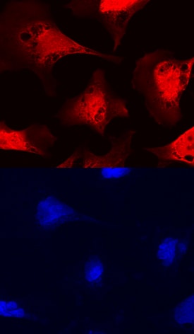 Fucosyltransferase 11/FUT11 antibody in NTera-2 Human Cell Line by Immunocytochemistry (ICC).